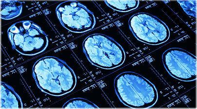 Brain scans